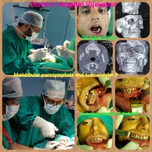 Kotwal Dentofacial Case Review-14