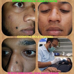 Kotwal Dentofacial Case Review-15