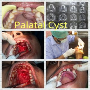 Kotwal Dentofacial Case Review-4