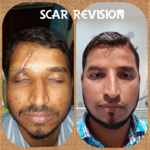 Kotwal Dentofacial Case Review-8