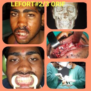 Kotwal Dentofacial Case Review-9